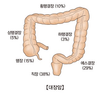 장 구성 사진 