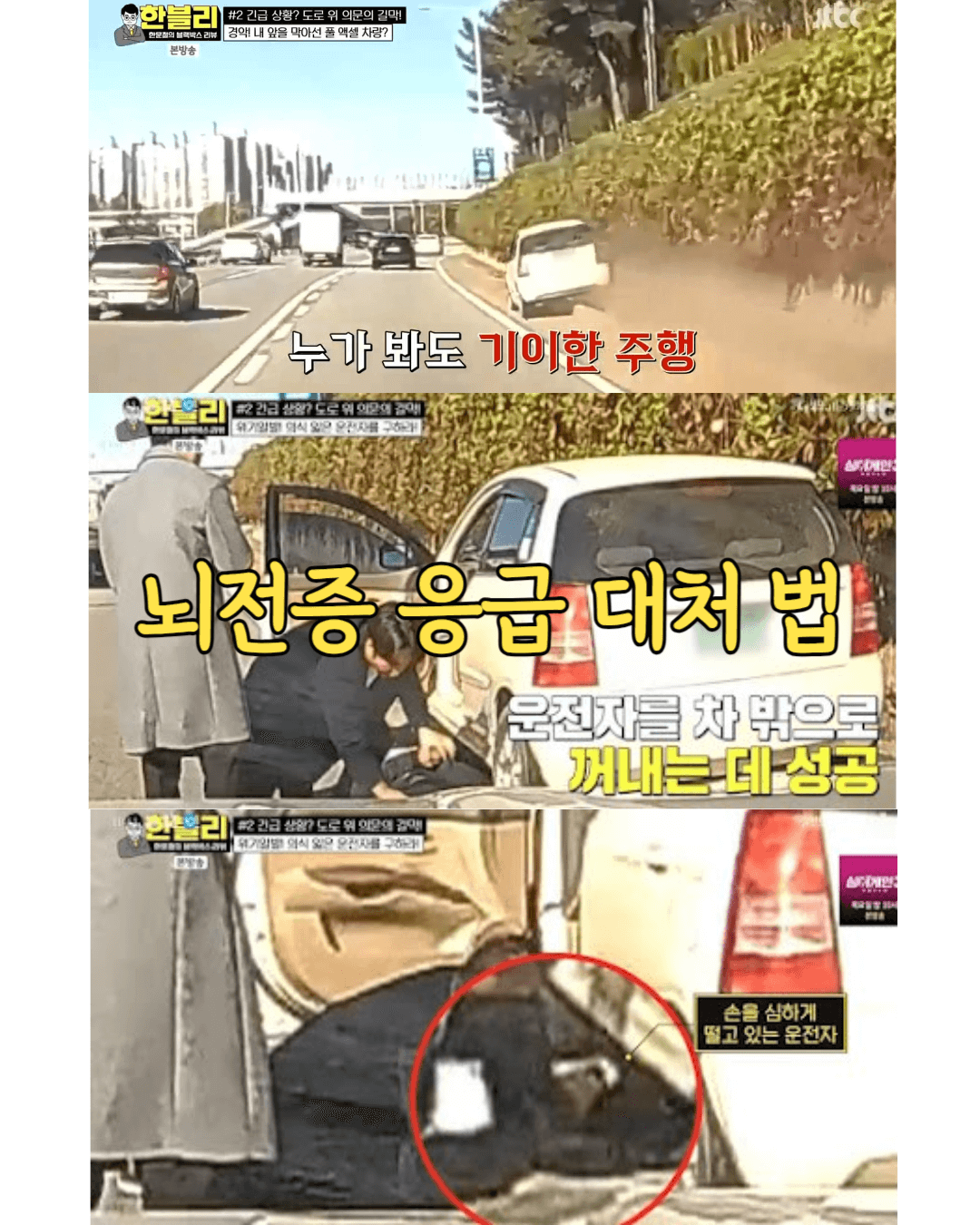 뇌전증 발작 증상 시 대처 방법