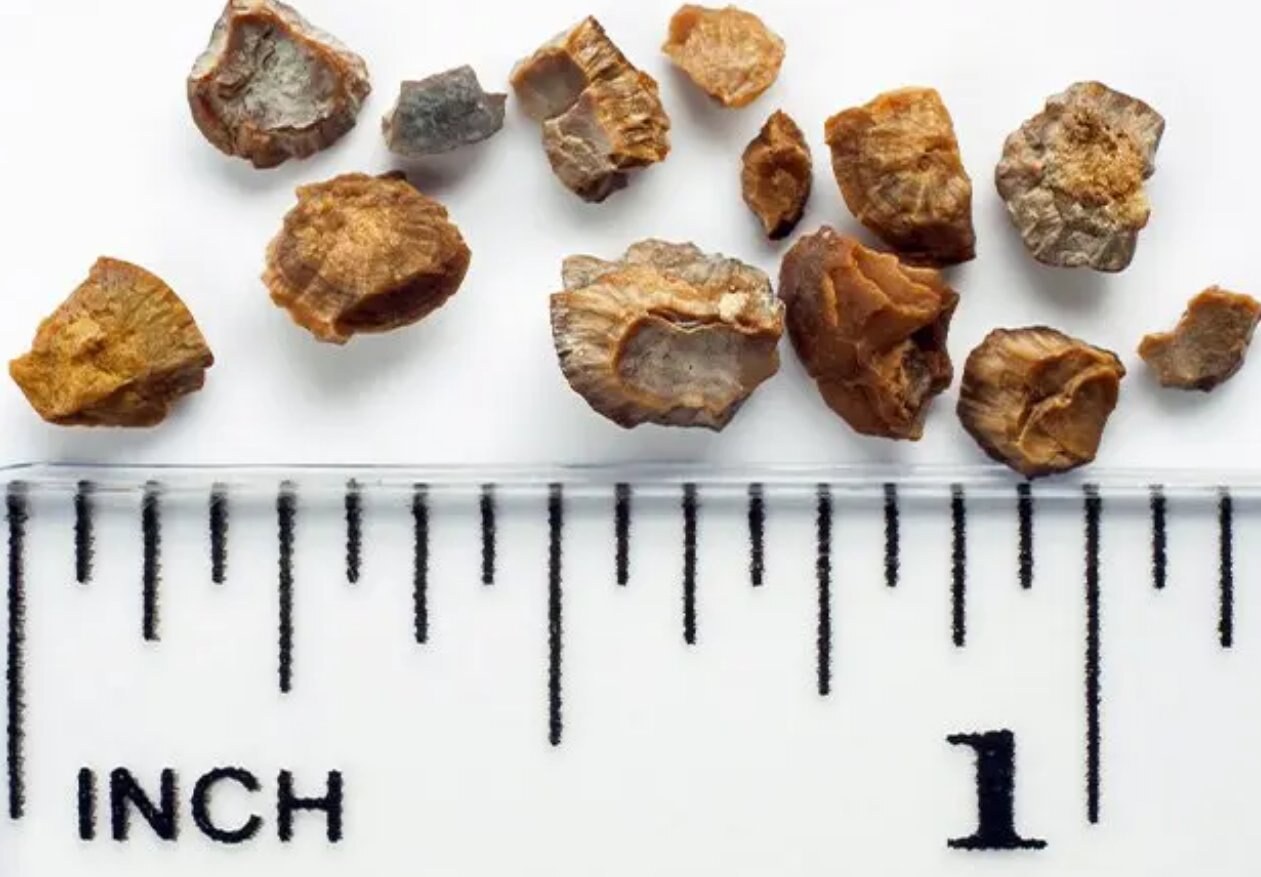 억 소리 나는 오른쪽 옆구리 통증 위치별 의심 질환 5가지와 꼭 봐야 할 위험 신호?!