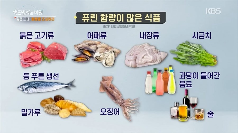 통풍에 좋은 음식 총정리 | 요산 수치 낮추는 식단, 피해야 할 음식, 생활관리까지